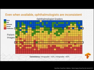 Case Study: TensorFlow in Medicine - Retinal Imaging (TensorFlow Dev Summit 2017)
 