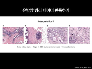 A B DC
Benign without atypia / Atypic / DCIS (ductal carcinoma in situ) / Invasive Carcinoma
Interpretation?
Elmore etl al. JAMA 2015
Diagnostic Concordance Among Pathologists
유방암 병리 데이터 판독하기
 