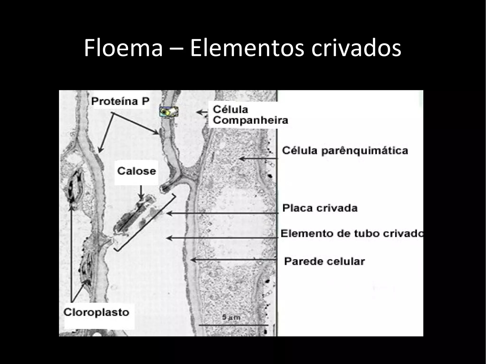 Floema – Elementos crivados