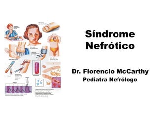 Síndrome
Nefrótico
Dr. Florencio McCarthy
Pediatra Nefrólogo
 
