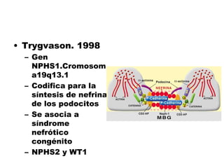 • Trygvason. 1998
– Gen
NPHS1.Cromosom
a19q13.1
– Codifica para la
síntesis de nefrina
de los podocitos
– Se asocia a
síndrome
nefrótico
congénito
– NPHS2 y WT1
 