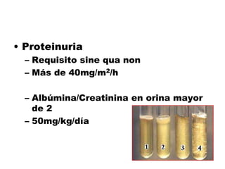 • Proteinuria
– Requisito sine qua non
– Más de 40mg/m2/h
– Albúmina/Creatinina en orina mayor
de 2
– 50mg/kg/día
 