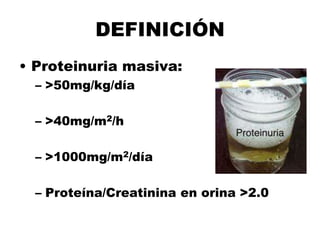 DEFINICIÓN
• Proteinuria masiva:
– >50mg/kg/día
– >40mg/m2/h
– >1000mg/m2/día
– Proteína/Creatinina en orina >2.0
 