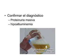 • Confirmar el diagnóstico
– Proteinuria masiva
– hipoalbuminemia
 
