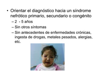• Orientar el diagnóstico hacia un síndrome
nefrótico primario, secundario o congénito
– 2 - 5 años
– Sin otros síntomas
– Sin antecedentes de enfermedades crónicas,
ingesta de drogas, metales pesados, alergias,
etc.
 