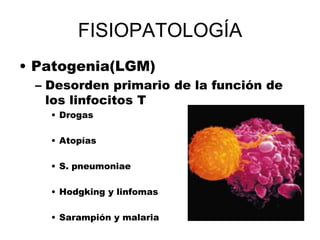 FISIOPATOLOGÍA
• Patogenia(LGM)
– Desorden primario de la función de
los linfocitos T
• Drogas
• Atopías
• S. pneumoniae
• Hodgking y linfomas
• Sarampión y malaria
 