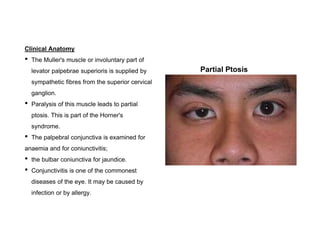 Eyelids & Lacrimal Apparatus | PPTX