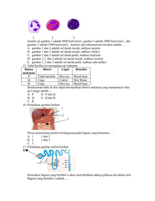 1


         1               2               3
    Jumlah sel gambar 1 adalah 4000 butir/mm3, gambar 2 adalah 2000 butir/mm3 , dan
    gambar 3 adalah 5500 butir/mm3, Analisis dari laboratorium tersebut adalah….
    A. gambar 1 dan 2 adalah sel darah merah, indikasi anemia
    B. gambar 1 dan 3 adalah sel darah merah, indikasi infeksi
    C. gambar 2 dan 3 adalah sel darah putih, indikasi leukimia
    D. gambar 1,2 dan 2 adalah sel darah merah, indikasi normal
    E. gambar 1, 2 dan 3 adalah sel darah putih, indikasi ada infeksi
15. Tabel berikut ini merupakan uji makanan
 Bahan            Biuret        Lugol      Benedict
makanan
     P       Tidak berubah Biru tua Merah bata
    Q        Ungu              Coklat     Biru Muda
    R        Ungu              Biru tua Merah bata
    Berdasarkan table di atas dapat disimpulkan bahwa makanan yang mempunyai nilai
    gizi tinggi adalah….
    A. P        D. P dan Q
    B. Q        E. Q dan R
    C. R
16. Perhatikan gambar berikut
                                1

                              2
                                  3



    Proses pencernaan protein berlangsung pada bagian yang bernomor….
    A. 1       1 dan 2
    B. 2       1 dan 3
    C. 3
17. Perhatikan gambar nefron berikut.
X




   Kerusakan bagian yang berlabel x akan menyebabkan adanya glukosa dai dalam urin.
   Bagian yang berlabel x adalah….
 