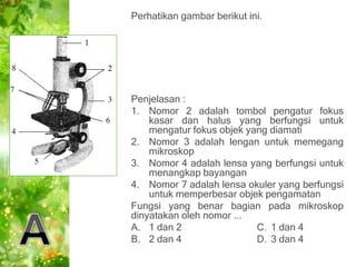 Perhatikan gambar berikut ini.




Penjelasan :
1. Nomor 2 adalah tombol pengatur fokus
    kasar dan halus yang berfungsi...