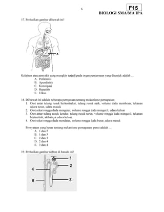 6
BIOLOGI SMA/MA IPA
F15
17. Perhatikan gambar dibawah ini!
Kelainan atau penyakit yang mungkin terjadi pada organ pencernaan yang ditunjuk adalah …
A. Peritonitis
B. Apendisitis
C. Konstipasi
D. Hepatitis
E. Ulkus
18. Di bawah ini adalah beberapa pernyataan tentang mekanisme pernapasan:
1. Otot antar tulang rusuk berkontraksi, tulang rusuk naik, volume dada membesar, tekanan
udara turun, udara masuk
2. Otot sekat rongga dada mengerut, volume rongga dada mengecil, udara keluar
3. Otot antar tulang rusuk kendur, tulang rusuk turun, volume rongga dada mengecil, tekanan
bertambah, akibatnya udara keluar
4. Otot sekat rongga dada mendatar, volume rongga dada besar, udara masuk
Pernyataan yang benar tentang mekanisme pernapasan perut adalah …
A. 1 dan 2
B. 1 dan 3
C. 2 dan 3
D. 2 dan 4
E. 3 dan 4
19. Perhatikan gambar nefron di bawah ini!
 