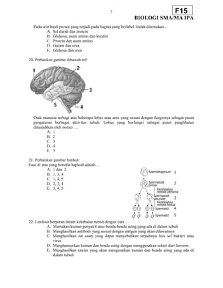 7
BIOLOGI SMA/MA IPA
F15
Pada urin hasil proses yang terjadi pada bagian yang berlabel 1tidak ditemukan…
A. Sel darah dan protein
B. Glukosa, asam amino dan kreatin
C. Protein dan asam amino
D. Garam dan urea
E. Glukosa dan urea
20. Perhatikan gambar dibawah ini!
Otak manusia terbagi atas beberapa lobus atau area yang sesuai dengan fungsinya sebagai pusat
pengaturan berbagai aktivitas tubuh. Lobus yang berfungsi sebagai pusat penglihatan
ditunjukkan oleh nomer …
A. 1
B. 2
C. 3
D. 4
E. 5
21. Perhatikan gambar berikut:
Fase di atas yang bersifat haploid adalah …
A. 1 dan 2
B. 1, 3, 4
C. 1, 4, 5
D. 2, 3, 4
E. 3, 4, 5
22. Limfosit berperan dalam kekebalan tubuh dengan cara ... .
A. Memakan kuman penyakit atau benda-benda asing yang ada di dalam tubuh
B. Menghasilkan antibodi yang sesuai dengan antigen yang akan dilawannya
C. Menghasilkan zat asam yang dapat menyebabkan terjadinya lisis sel bakteri atau
virus
D. Menghancurkan kuman dan benda asing dengan menggunakan sekret dari lisosom
E. Menghasilkan enzim yang akan menguraikan kuman dan benda asing yang ada di
dalam tubuh
 