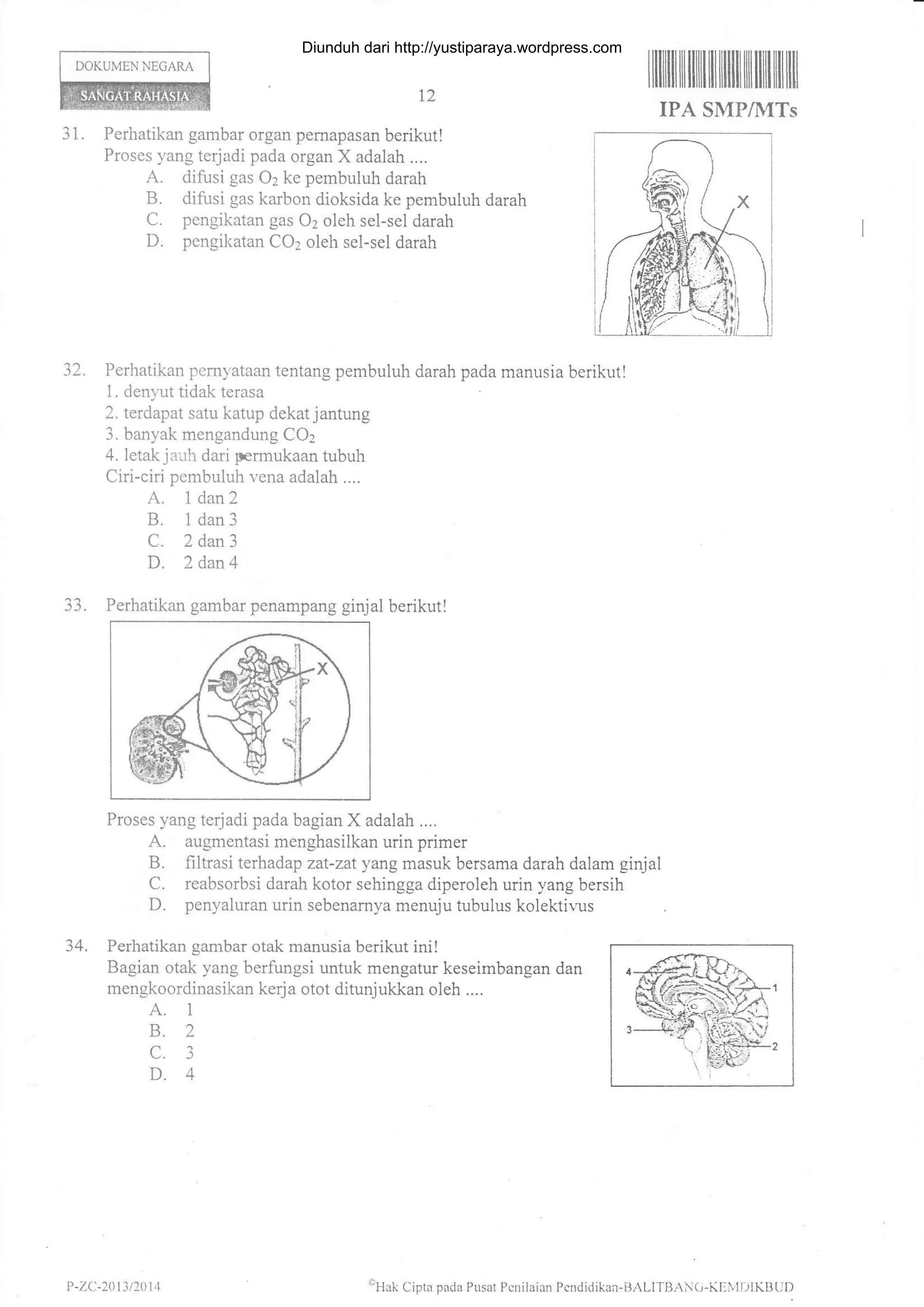 DOKUMEN NEGAM
31. Perhatikan gambar organ pemapasan berikutl
Proses yang terjadi pada organ X adalah ....
A. difusi gas 2 ke pembuluh darah
B. difusi gas karbon dioksida ke pembuluh darah
C. pengikatan gas 02 oleh sel-sel darah
D. pengikatan CO2 oleh sel-sel darah
32. Perhatikan pernyataan tentang pembuluh darah pada manusia berikut!
l. denl ut tidak terasa
2. terdapat satu katup dekat j antung
3. banyak mengandung CO2
4. letak j a-rh dari permukaan tubuh
Ciri-ciri pembuluh vena adalah ....
A. l dan2
B. 1dan3
C. 2 dan3
D. 2 dan 4
33. Perhatikan gambar penampang ginjal berikut!
l2
llllllilril rililrilllfiil] tililill tfl ilil
IPA SMP/MTs
Proses yang terj adi pada bagian X adalah ....
A. augmentasi menghasilkan urin primer
B. filtrasi terhadap zat-zat yang masuk bersama darah dalam ginjal
C. reabsorbsi darah kotor sehingga diperoleh urin yang bersih
D. penyaluran urin sebenamya menuju tubulus kolektir.us
34. Perhatikan gambar otak manusia berikut ini!
Bagian otak yang berfungsi untuk mengatur keseirnbangan dan
mengkoordinasikan kerj a otot ditunjukkan oleh ....
A. 1
B.2
c.3
D.4
cHak Cipta pada Pusai Pcnilaian Pcndidikan-BALITBA,(r-KElvil)lKlltrD| -z(:-201 3 t201 4
Diunduh dari http://yustiparaya.wordpress.com
 