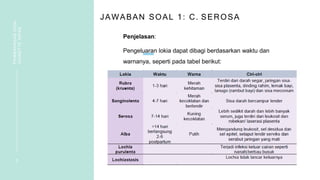 JAWABAN SOAL 1: C. SEROSA
Penjelasan:
Pengeluaran lokia dapat dibagi berdasarkan waktu dan
warnanya, seperti pada tabel berikut:
3
PEMBAHASAN
SOAL
VIGNETTE
NIFAS
 