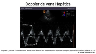 Doppler de Vena Hepática
Tung-Chen Y, García de Casasola-Sánchez G, Méndez-Bailón Medición de la congestión venosa empleando la ecografía: protocolo VExUS. Galicia Clin 2022; 83-2: 32
37 doi.org/10.22546/65/2621
 