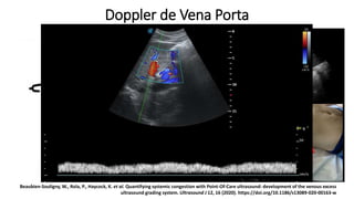Beaubien-Souligny, W., Rola, P., Haycock, K. et al. Quantifying systemic congestion with Point-Of-Care ultrasound: development of the
venous excess ultrasound grading system. Ultrasound J 12, 16 (2020). https://doi.org/10.1186/s13089-020-00163-w
Beaubien-Souligny, W., Rola, P., Haycock, K. et al. Quantifying systemic congestion with Point-Of-Care ultrasound: development of the venous excess
ultrasound grading system. Ultrasound J 12, 16 (2020). https://doi.org/10.1186/s13089-020-00163-w
Doppler de Vena Porta
 