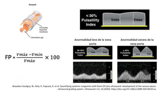 Beaubien-Souligny, W., Rola, P., Haycock, K. et al. Quantifying systemic congestion with Point-Of-Care ultrasound: development of the venous excess
ultrasound grading system. Ultrasound J 12, 16 (2020). https://doi.org/10.1186/s13089-020-00163-w
 