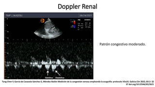 Doppler Renal
Patrón congestivo moderado.
Tung-Chen Y, García de Casasola-Sánchez G, Méndez-Bailón Medición de la congestión venosa empleando la ecografía: protocolo VExUS. Galicia Clin 2022; 83-2: 32
37 doi.org/10.22546/65/2621
 