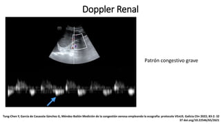 Doppler Renal
Patrón congestivo grave
Tung-Chen Y, García de Casasola-Sánchez G, Méndez-Bailón Medición de la congestión venosa empleando la ecografía: protocolo VExUS. Galicia Clin 2022; 83-2: 32
37 doi.org/10.22546/65/2621
 