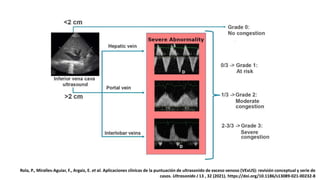 Rola, P., Miralles-Aguiar, F., Argaiz, E. et al. Aplicaciones clínicas de la puntuación de ultrasonido de exceso venoso (VExUS): revisión conceptual y serie de
casos. Ultrasonido J 13 , 32 (2021). https://doi.org/10.1186/s13089-021-00232-8
 