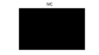 IVC
 