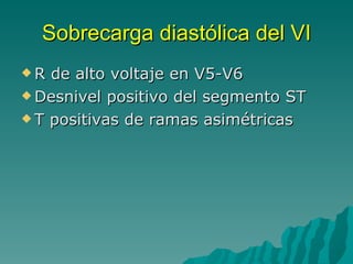 Sobrecarga diastólica del VI R de alto voltaje en V5-V6 Desnivel positivo del segmento ST T positivas de ramas asimétricas 