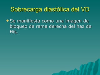 Sobrecarga diastólica del VD Se manifiesta como una imagen de bloqueo de rama derecha del haz de His. 