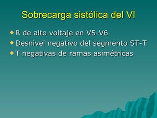 Sobrecarga sistólica del VI R de alto voltaje en V5-V6 Desnivel negativo del segmento ST-T T negativas de ramas asimétricas 