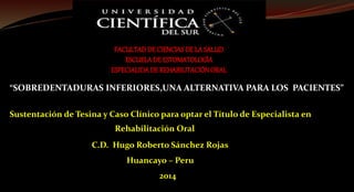 Sustentación de Tesina y Caso Clínico para optar el Título de Especialista en
C.D. Hugo Roberto Sánchez Rojas
Huancayo – Peru
2014
FACULTADDE CIENCIASDE LA SALUD
ESCUELADE ESTOMATOLOGÍA
ESPECIALIDADE REHABILITACIÓNORAL
“SOBREDENTADURAS INFERIORES,UNA ALTERNATIVA PARA LOS PACIENTES”
Rehabilitación Oral
 