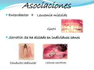 Asociaciones
 Enterobacter + Leucemia mieloide


                         GUN

 Serratia: Se ha aislado en individuos sanos




  Conducto radicular    Lesiones necróticas
 
