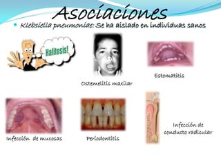 Asociaciones
   Klebsiella pneumoniae: Se ha aislado en individuas sanos




                                             Estomatitis
                       Ostemelitis maxilar




                                                   Infección de
                                                conducto radicular
Infección de mucosas    Periodontitis
 