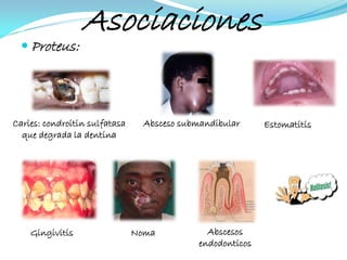 Asociaciones
  Proteus:




Caries: condroitin sulfatasa     Absceso submandibular      Estomatitis
  que degrada la dentina




    Gingivitis                 Noma            Abscesos
                                             endodonticos
 
