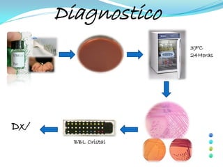 Diagnostico
                      37°C
                      24Horas




Dx/
        BBL Cristal
 