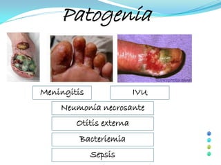 Patogenia


Meningitis               IVU
    Neumonía necrosante
        Otitis externa
         Bacteriemia
             Sepsis
 