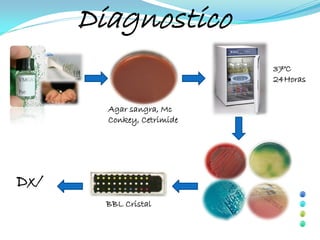 Diagnostico
                            37°C
                            24Horas


        Agar sangra, Mc
        Conkey, Cetrimide




Dx/
        BBL Cristal
 
