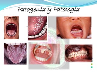 Patogenia y Patología
 