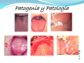 Patogenia y Patología
 