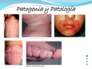Patogenia y Patología
 
