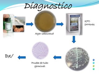 Diagnostico
                          37°C
                          24Horas


         Agar sabouraud




Dx/
       Prueba de tubo
         germinal
 