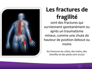 Les fractures de
fragilité
sont des fractures qui
surviennent spontanément ou
après un traumatisme
mineur, comme une chute de
hauteur de position debout ou
moins
les fractures du crâne, des mains, des
chevilles et des pieds sont exclus
 