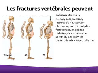 Les fractures vertébrales peuvent
entraîner des maux
de dos, la dépression,
la perte de hauteur, un
abdomen protubérant, des
fonctions pulmonaires
réduites, des troubles de
sommeil, des activités
perturbées de vie quotidienne
 
