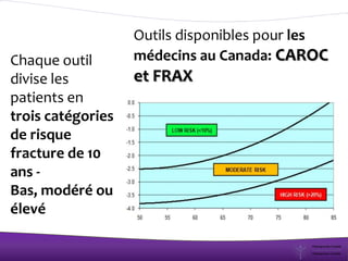 Outils disponibles pour les
médecins au Canada: CAROC
et FRAX
Chaque outil
divise les
patients en
trois catégories
de risque
fracture de 10
ans -
Bas, modéré ou
élevé
 