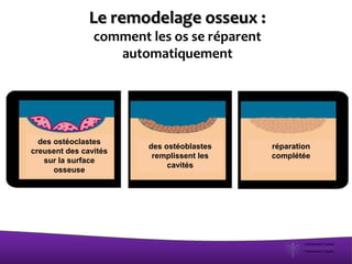 Le remodelage osseux :
comment les os se réparent
automatiquement
des ostéoclastes
creusent des cavités
sur la surface
osseuse
des ostéoblastes
remplissent les
cavités
réparation
complétée
 