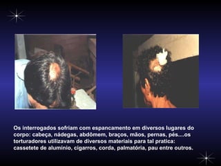 Os interrogados sofriam com espancamento em diversos lugares do corpo: cabeça, nádegas, abdômem, braços, mãos, pernas, pés....os torturadores utilizavam de diversos materiais para tal pratica: cassetete de alumínio, cigarros, corda, palmatória, pau entre outros.  
