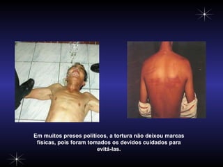 Em muitos presos políticos, a tortura não deixou marcas físicas, pois foram tomados os devidos cuidados para evitá-las. 