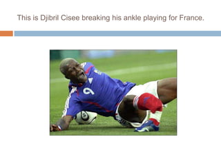 This is Djibril Cisee breaking his ankle playing for France.
 