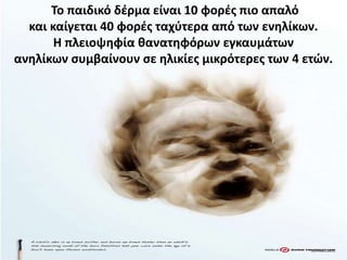 Το παιδικό δζρμα είναι 10 φορζσ πιο απαλό
  και καίγεται 40 φορζσ ταχφτερα από των ενθλίκων.
       Η πλειοψθφία κανατθφόρων εγκαυμάτων
ανθλίκων ςυμβαίνουν ςε θλικίεσ μικρότερεσ των 4 ετϊν.
 