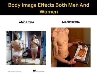       Males often begin an eating disorder at older ages than females do; they often have a history of obesity or are overweight. Men are also made up to be strong and powerful, to build their bodies and make them large so they can compete successfully, and defend and protect. Men usually think their bodies are fine the way they are, if they do have a concern, they often want to bulk up and become larger and more muscular, not tiny like women are. Males usually think thin is a sign of weakness.         Because eating disorders have been described as female problems, males are often reluctant to admit their problem and need help (Jackson & Grilo, 2002). Research shows that males who complete treatment have better outcomes. Reasons men with eating disorders diet: A desire to improve athletic performance.Ahistory of being teased, criticized, or picked on for being overweight. Attractive to a potential partner.  Looking less like one’s father and to look more like models in magazines.
