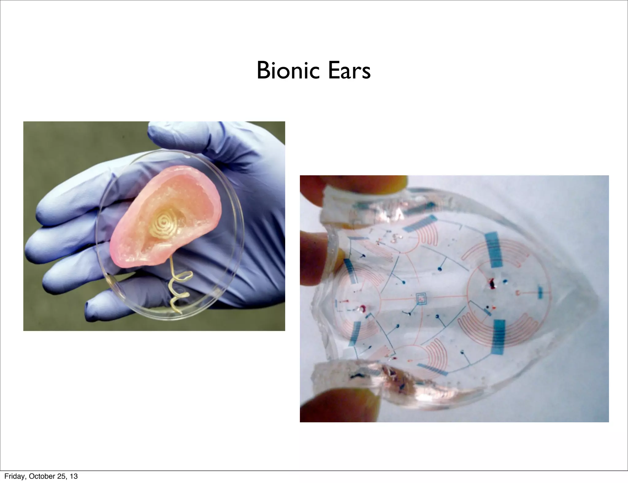Bionic Ears

Friday, October 25, 13

 