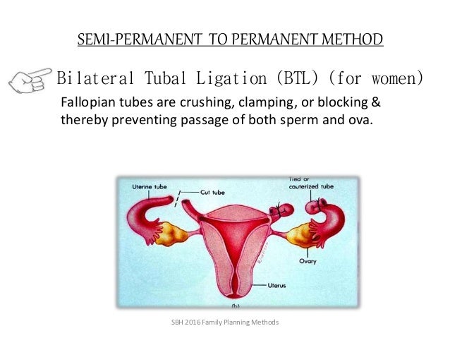 Best family planning options