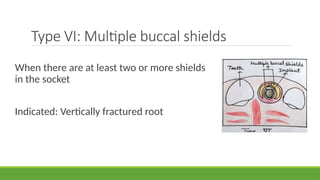 Socket‑Shield Technique – A New Method.pptx